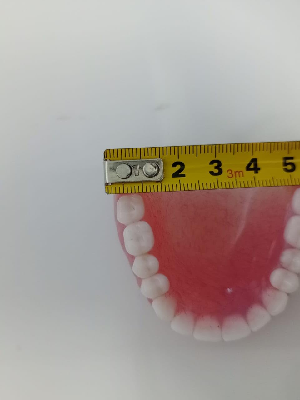 Upper Denture U957