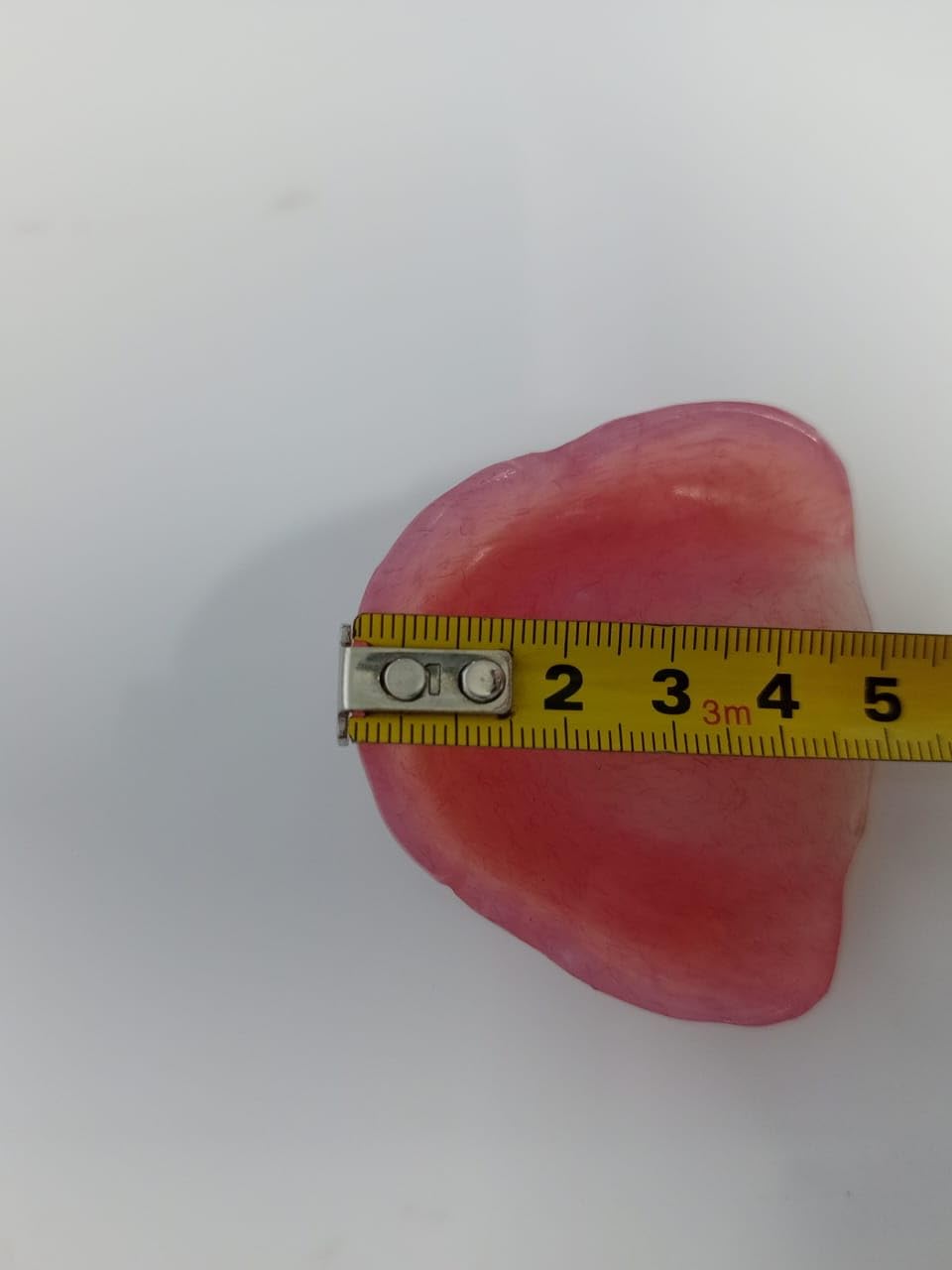 Upper Denture U957