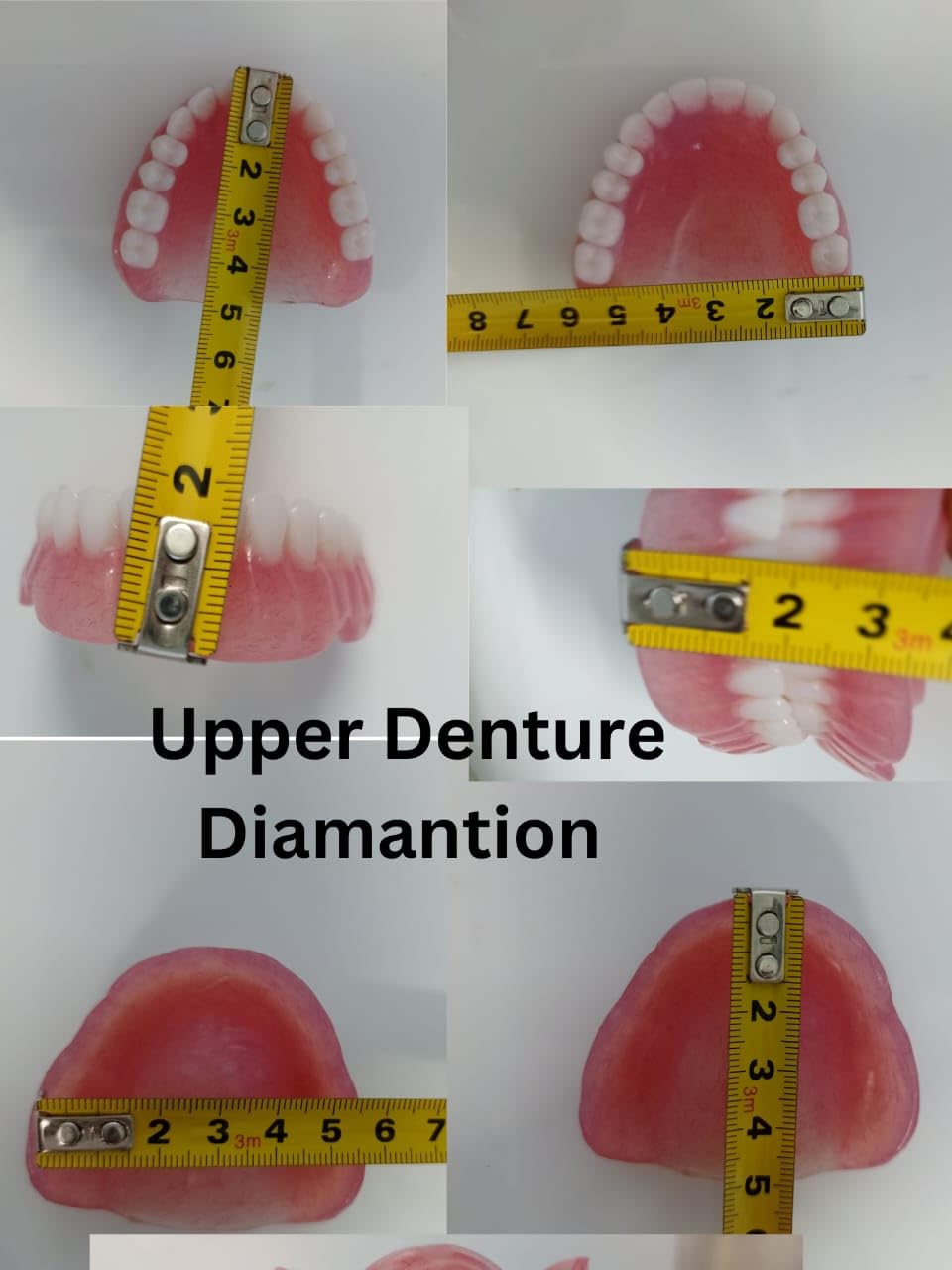 Upper Denture U957